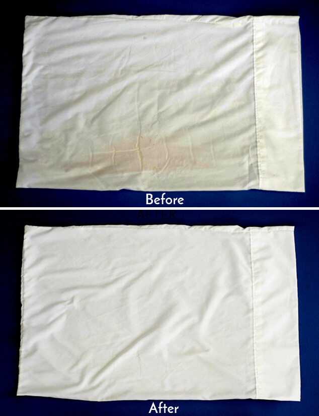 Miracle Whitening Solution