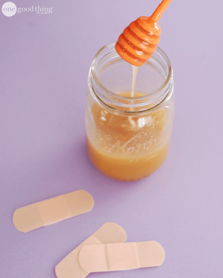 10 Easy Home Remedies for Summer Wounds and Woes