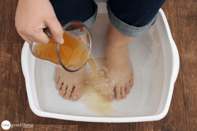 Ways You Can Benefit From Apple Cider Vinegar