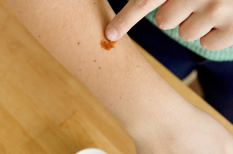 uses for cinnamon