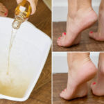 Listerine Foot Soak