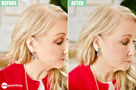 droopy earring cure