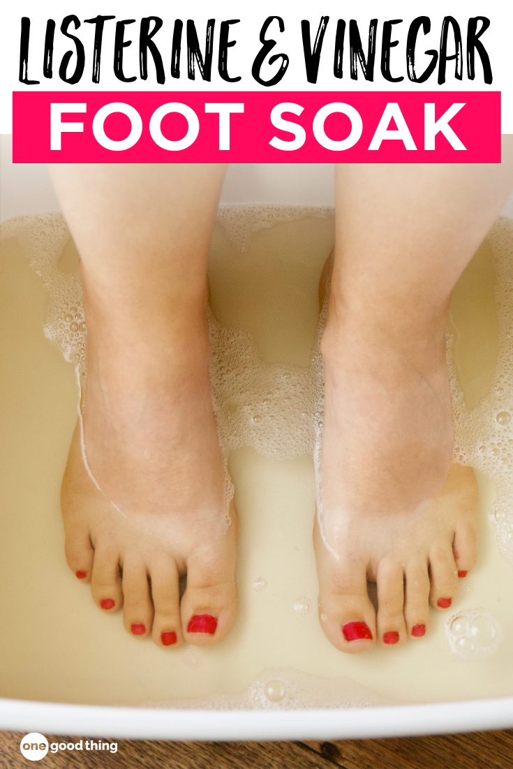 Listerine Foot Soak Why It Works & How To Do It