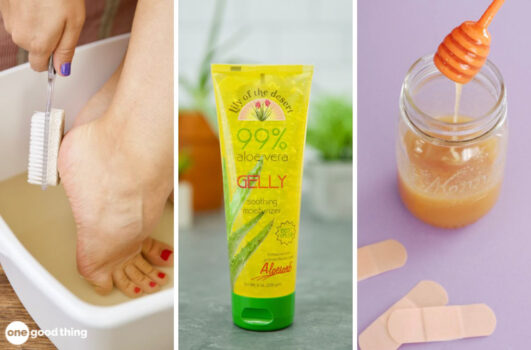 Home Remedies For Summer Wounds And Woes collage: using pumice stone on heel; aloe gel; jar of honey and some bandaids.
