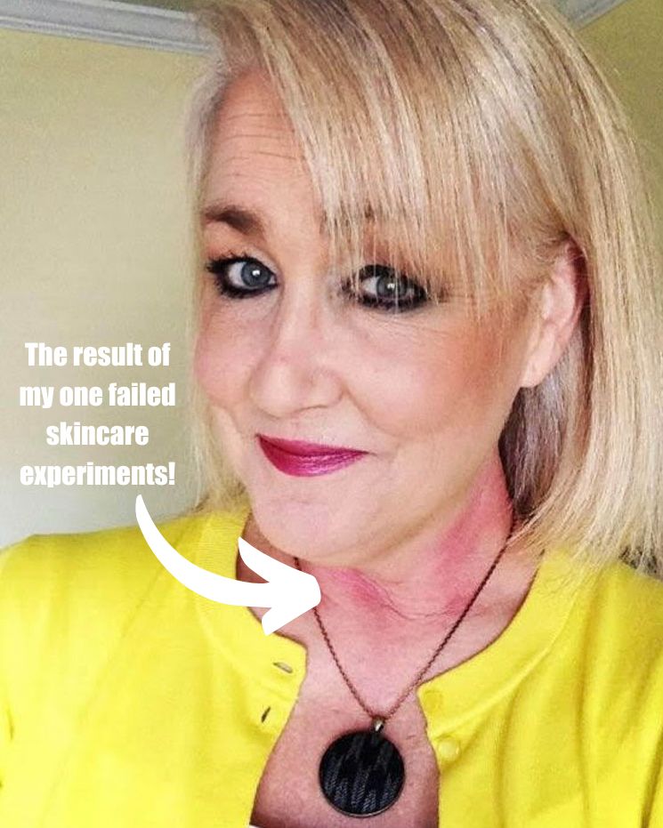 skincare confessions_6 A woman with blonde hair wears a yellow top and a necklace, showing red skin on her neck with text: